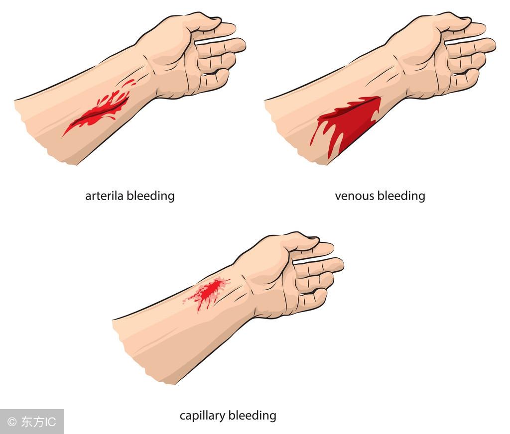 落地生根什么時(shí)候開(kāi)花，落地生根怎么治痔瘡?